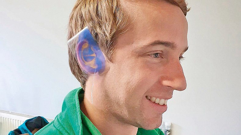 Mann mit Otoplastik am Ohr