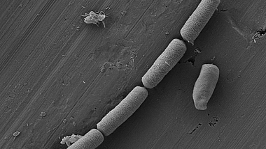 Elektronenmikroskop-Aufnahme stäbchenförmiger Mikroben in Beton.