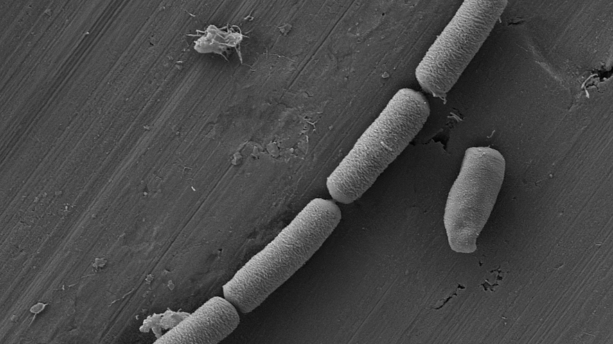Elektronenmikroskop-Aufnahme stäbchenförmiger Mikroben in Beton.